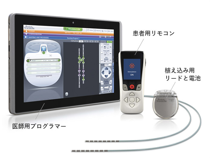 脊髄刺激療法に使用する機材例1