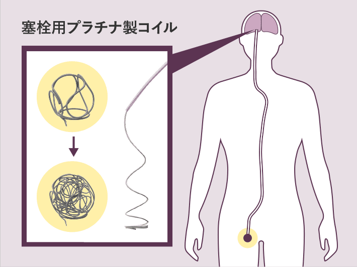 図 塞栓用プラチナ製コイル