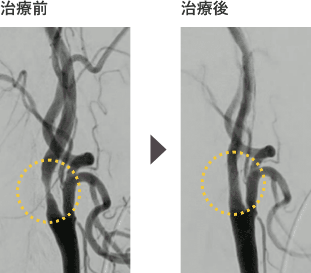 治療前・治療後