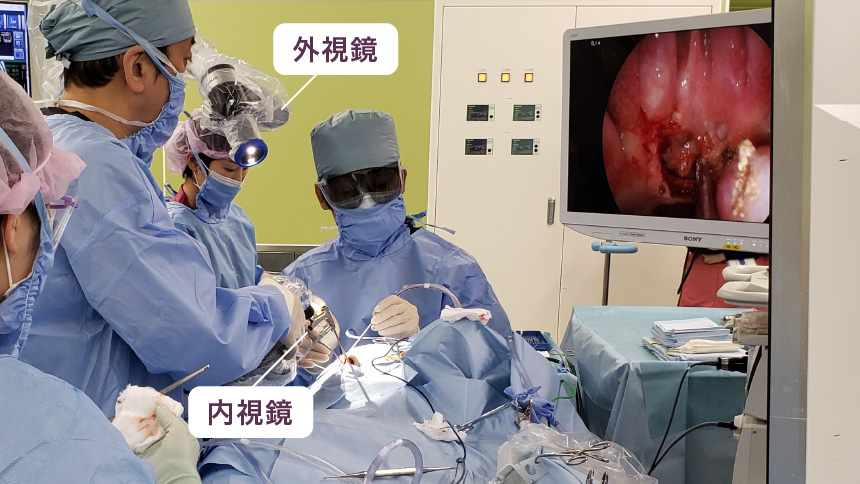 小開頭手術＋経鼻内視鏡手術
