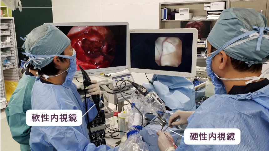 穿頭経脳室内視鏡手術＋経鼻内視鏡手術