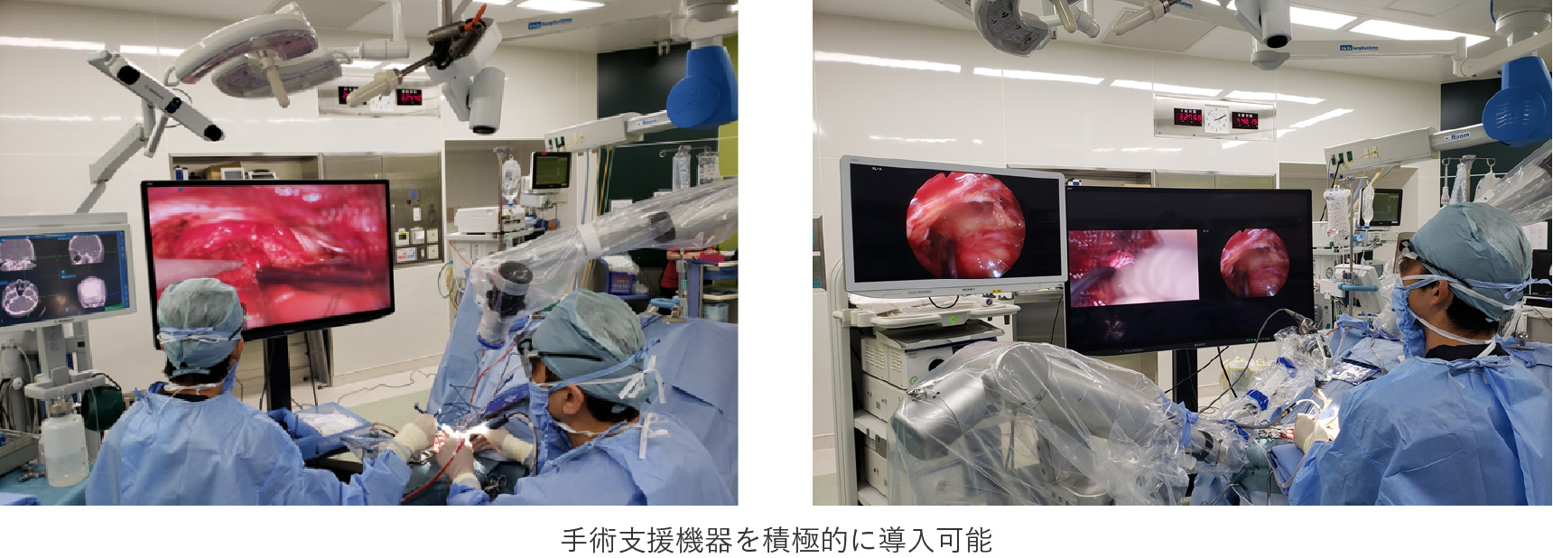 ORBEYEの特徴：広い手術空間